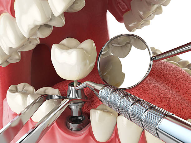 Best Emergency Cosmetic Dentistry (e.g., broken veneers) in Holiday Valley, OH